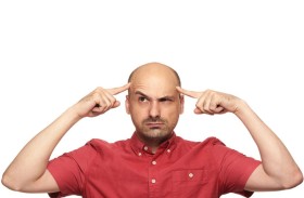 اكتشاف طفرات جينية نادرة وراء الصلع عند الرجال
