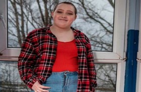 تنتزع خصلات شعرها 100 مرة يومياً 