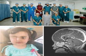 مستشفى توام ينقذ حياة طفلة من ورم معقد في قاعدة الجمجمة 