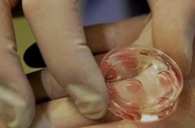 تجميد البويضات.. تقنية تشهد إقبالا متزايدا في لبنان