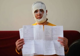 أم تخسر وجهها في مركز تجميل 