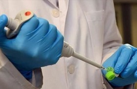 دراسة: اختبار اللعاب يتفوق على الدم في كشف سرطان البروستاتا