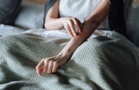 دراسة تكشف عن ارتباط الإكزيما بأمراض الكلى المزمنة