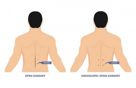 مستشفى الجامعة بالشارقة يُدخل الجراحة بالمنظار في مركز هيمشان لجراحة العمود الفقري والمفاصل
