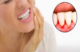 أطعمة تحمي من نزيف اللثة