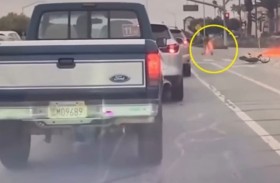 مراهق يحترق بعد انفجار دراجته النارية