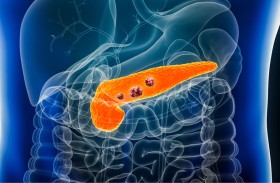 اكتشاف سبب غير متوقع لنمو سرطان البنكرياس