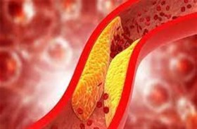علاج واعد للكوليسترول من مرة واحدة