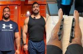 يدفع 100 ألف دولار ليصبح أطول من زوجته