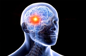 أعراض يومية شائعة قد تكون مؤشرات على أورام الدماغ