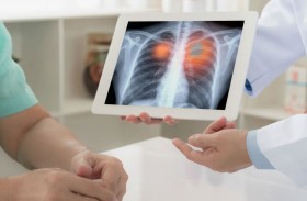 اكتشاف السرطان يكون  متأخراً للرجال مقارنة بالنساء 