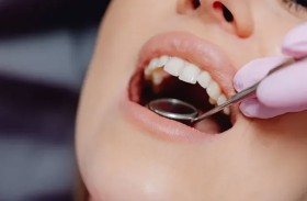 دليل على السرطان والإيدز.. علامات تظهر في الفم احذرها جيدا