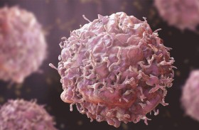 ارتفاع حاد في وفيات بالسرطان بحلول 2050 