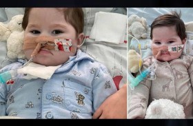 قاضية تحكم بإنهاء حياة طفل 