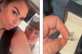 خاتم خطوبة يهدد إصبع شابة بـ«البتر»