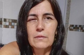 يلصق عين حبيبته بعدما أخطاً بين الصمغ وقطرة العيون