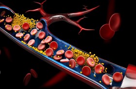 ما الفرق بين الكوليسترول الجيد والضار؟