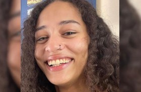 مقتل فتاة في هجوم كلاب ترعاها بالمنزل