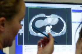 آكلة الدماغ.. أكثر الطفيليات فتكاً    