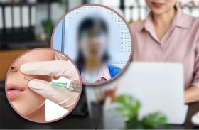 تختلس 2.5 مليون دولار لإجراء عمليات تجميل