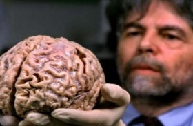 الحبوب المنومة لإصلاح تلف الدماغ