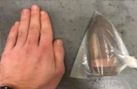 إخلاء مستشفى.. بسبب قذيفة من الحرب العالمية الاولى  داخل جسد مريض!