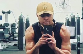 يتعافى بأعجوبة من صدمتين كهربائتين عنيفتين