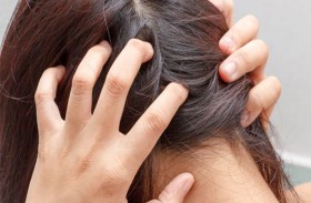 أسباب حكة فروة الرأس