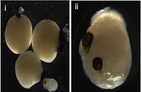 زراعة هياكل للعين يمكنها استشعار الضوء في المختبر