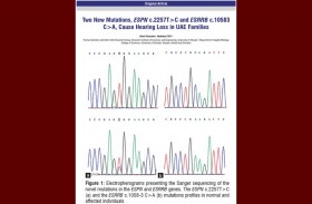 باحثون من جامعة الشارقة يكتشفون المسببات المسؤولة عن الصمم الوراثي