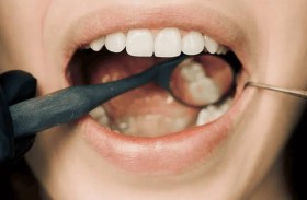 قد تبدأ في الفم..  طبيبة تكشف أمراضا خطيرة لا علاقة لها بالأسنان