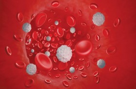 أعراض سرطان الدم  التي تظهر في الصباح