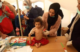 أونروا : تزايد معدلات سوء التغذية في غزة.. والضفة تشهد حربا صامتة