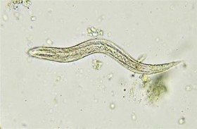 لماذا يصاب الأطفال بالديدان كثيراً؟